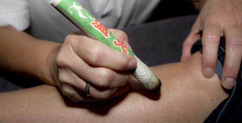 Acupunctuur Dineke Gast Acupunctuur Almelo